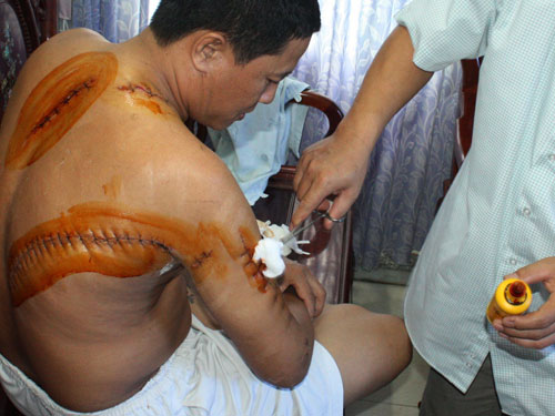 Truy quét tội phạm vùng giáp ranh