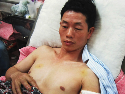 Nổ lò luyện thép làm 2 người chết, 6 người bị thương