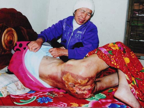 Phạt chủ nhà bạo hành dã man người giúp việc 18 tháng tù