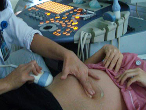 Một thai nhi sắp sinh chết lưu bất thường tại bệnh viện
