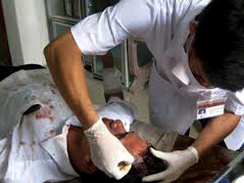 Hải Phòng: Em nghiện vác dao chém anh vừa đi tù về