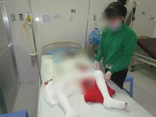 Vụ gia đình bị đốt khi đang ngủ: Bé gái 10 tuổi đã chết