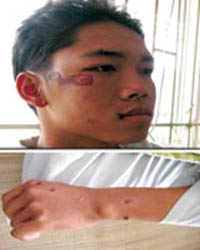 Một quân nhân bị dân quân đánh trọng thương