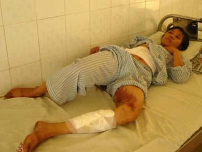 Chân dung kẻ tưới nồi canh đang sôi vào người vợ