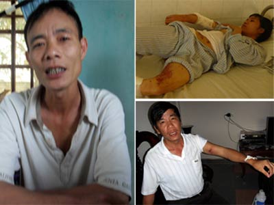 Khởi tố kẻ tưới nồi canh đang sôi vào người vợ