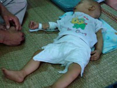 Bị ung thư máu lại tưởng viêm phổi