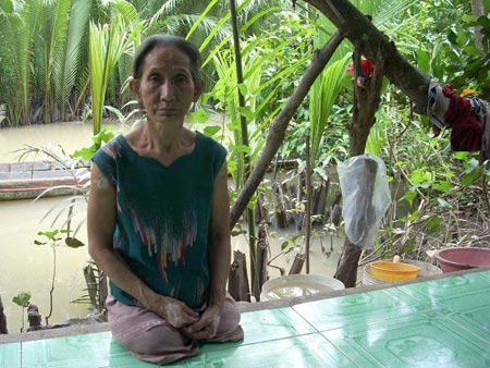 Những “người nhện” tật nguyền
