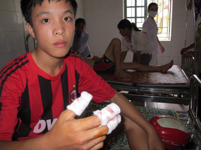 Hà Tĩnh: Nổ bom bi, 5 học sinh trọng thương