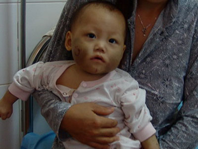 Truy tố cha dượng và mẹ bé Như Ý