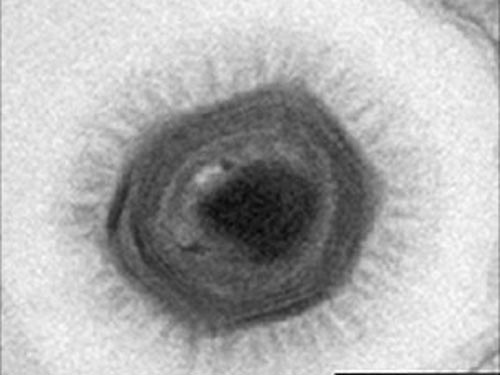 Phát hiện virus lớn nhất thế giới
