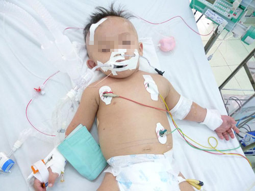 Cứu sống bệnh nhi xuất huyết phổi, trụy tim
