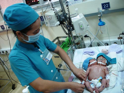 Bé hai đầu ở Sóc Trăng đã qua đời