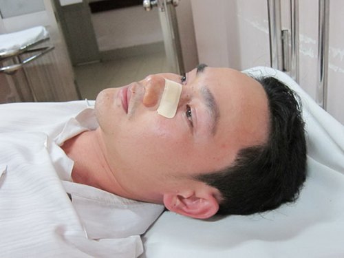 CSGT đập người đi đường gãy mũi