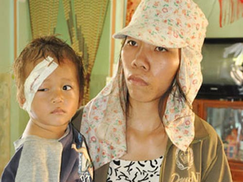 B&eacute; 19 th&aacute;ng tuổi bị mẹ ngược đ&atilde;i