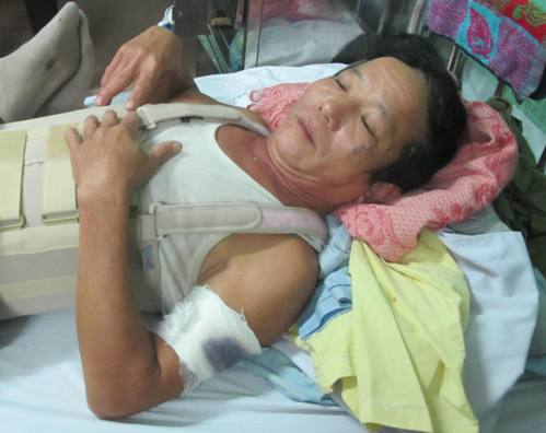 “Cẩu tặc” táo tợn chém trọng thương người truy đuổi