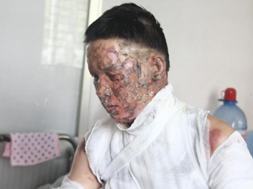 Những ca cấp cứu khó tin