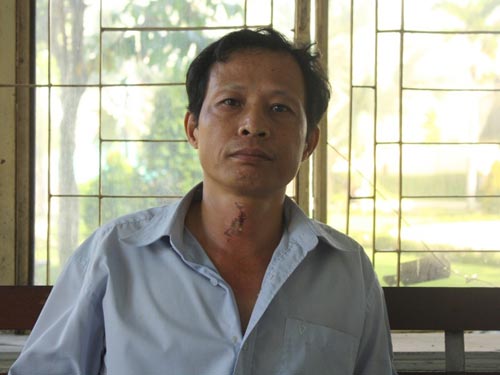 Kẻ tạt axit tàn độc chỉ bị khởi tố tội "Cố ý gây thương tích"