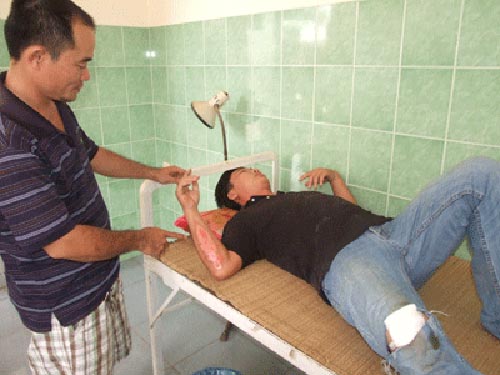 “Hiệp sĩ” gặp nạn khi truy bắt trộm