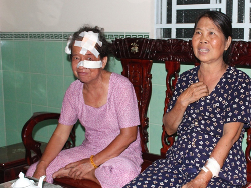 Đốt nhà, chặn cửa trước, chém tới tấp 5 người