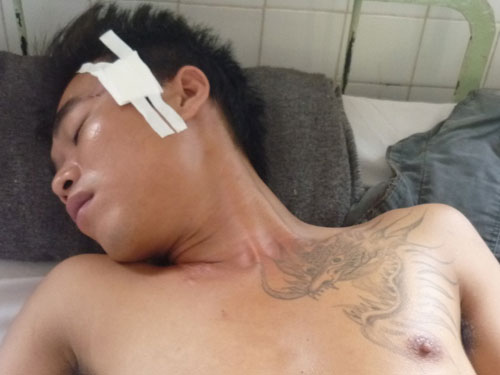 Hai nhóm hỗn chiến, một thanh niên bị bắn vào đầu