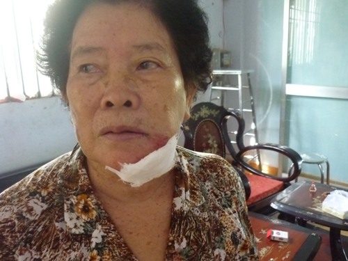 Tiểu bậy bị nhắc, đập phá, chém chủ nhà