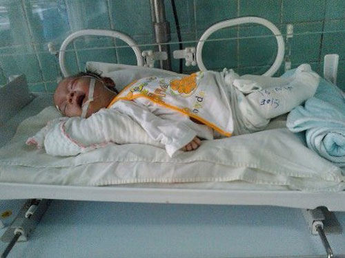 Bé sơ sinh bị mẹ bỏ rơi vì... tật nguyền