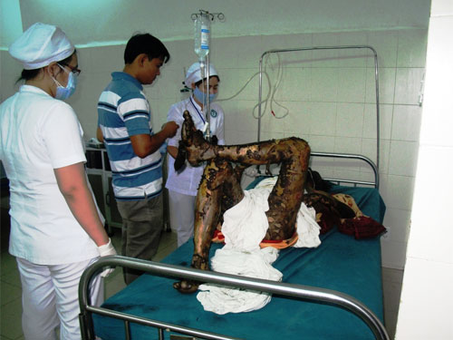 Một người đàn ông tự thiêu