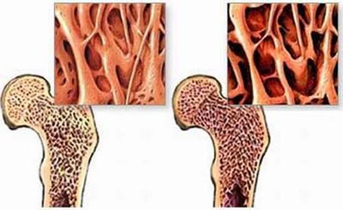 Bệnh nhân ung thư giai đoạn cuối bỗng… hồi sinh