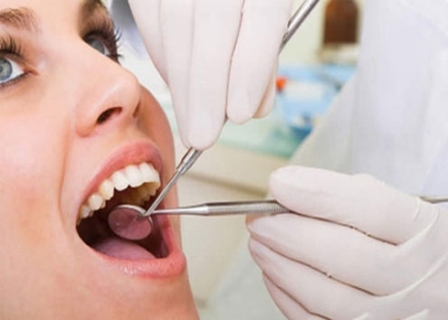 Những điều cần biết về cạo vôi răng