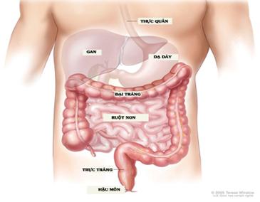 Phát hiện ung thư đại tràng qua hơi thở