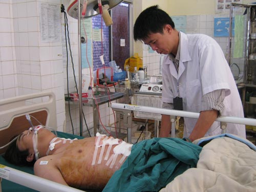 Thoát chết sau khi bị đâm 2 nhát trúng tim