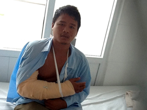 Nối thành công cánh tay sắp mất