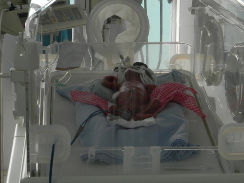 Trọng lượng bé trai suýt bị chôn sống giảm