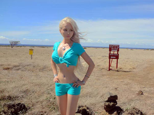 Hội chứng búp bê Barbie