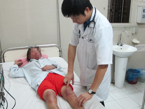 Dị ứng thuốc nam