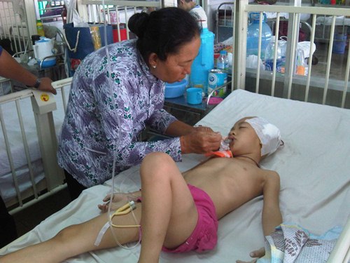 TPHCM: Đi học bị té lầu, bé gái 6 tuổi nứt sọ