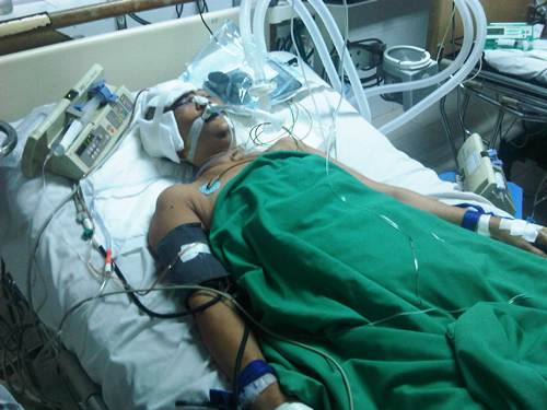 Chồng chém bể đầu vợ giữa đêm khuya