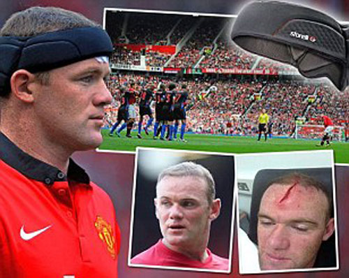 Khám phá chiếc băng đầu đặc biệt của Rooney