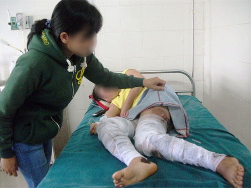 Chồng tạt xăng đốt vợ