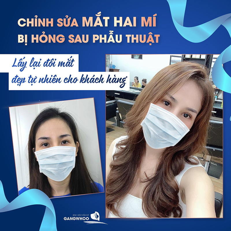Ảnh: Gangwhoo