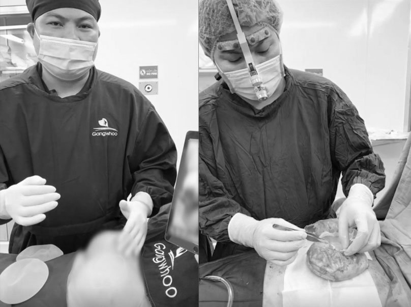 B&aacute;c sĩ BVTM Gangwhoo &ldquo;giải cứu&rdquo; những ca n&acirc;ng ngực hỏng khi n&acirc;ng ngực qu&aacute; to, k&iacute;ch thước t&uacute;i n&acirc;ng ngực kh&ocirc;ng ph&ugrave; hợp 
