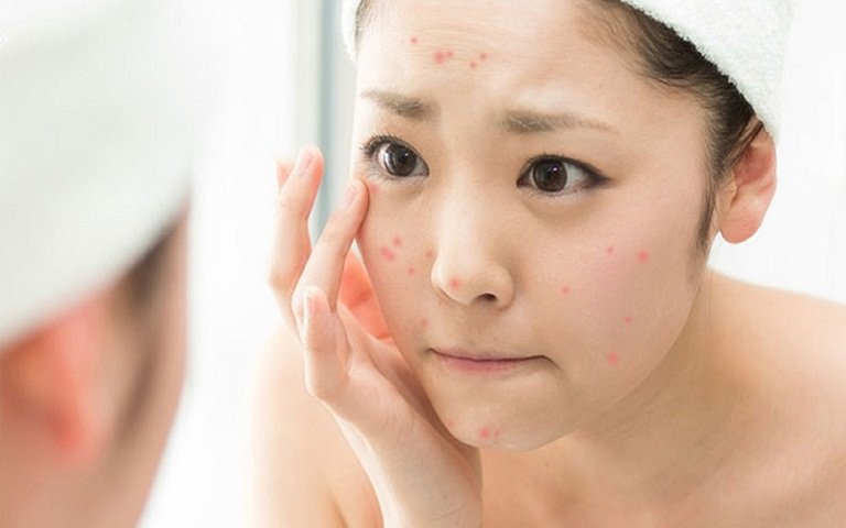 Mặt nạ đu đủ cho da mụn