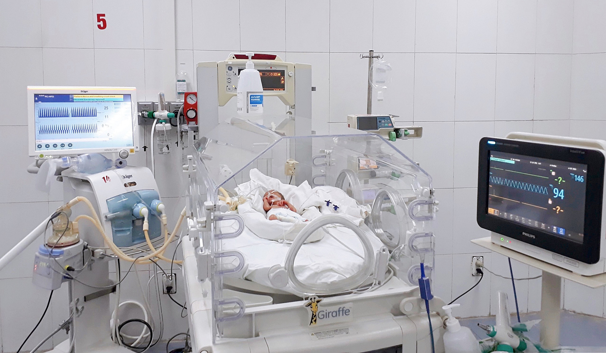 B&eacute; A.B. được thở m&aacute;y tần số cao HFO tại Khu C&aacute;ch ly của Bệnh viện Sản Nhi Bắc Giang
