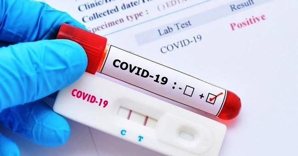 trong đ&oacute; tăng cường kiểm tra việc nhập khẩu, kinh doanh, mua sắm c&aacute;c loại test kit x&eacute;t nghiệm nhanh v&agrave; x&eacute;t nghiệm RT-PCT.