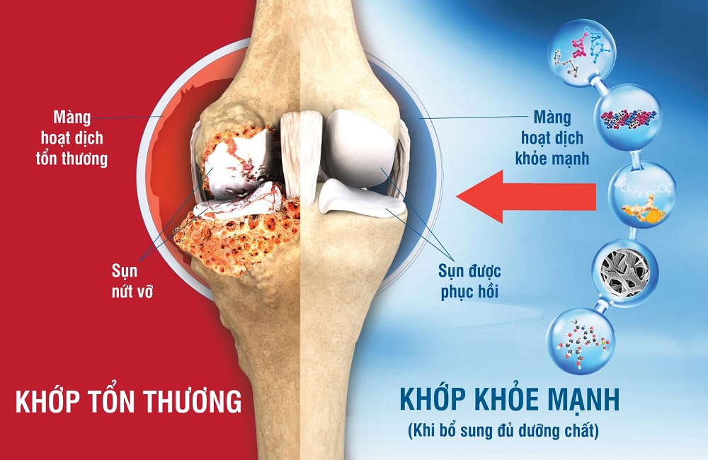 Những dưỡng chất trong JEX thế hệ mới được chứng minh c&oacute; khả năng điều h&ograve;a miễn dịch, ức chế vi&ecirc;m, từ đ&oacute; hỗ trợ giảm đau nhức v&agrave; ph&ograve;ng bệnh khớp dịp Tết. Ảnh: ECO