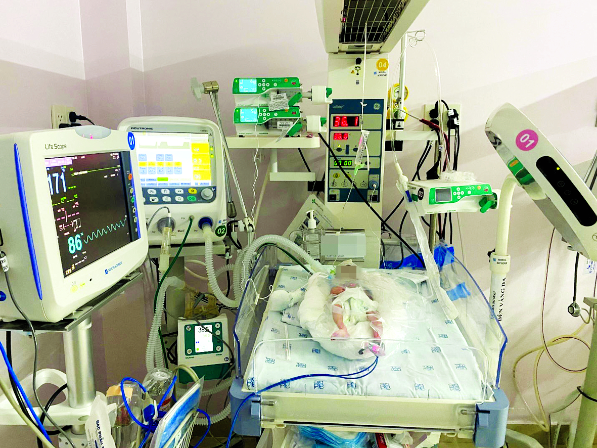 Một em bé đang được điều trị tại Khoa Sơ sinh, Bệnh viện Đại học Y Dược TP.HCM - ẢNH: T.M.