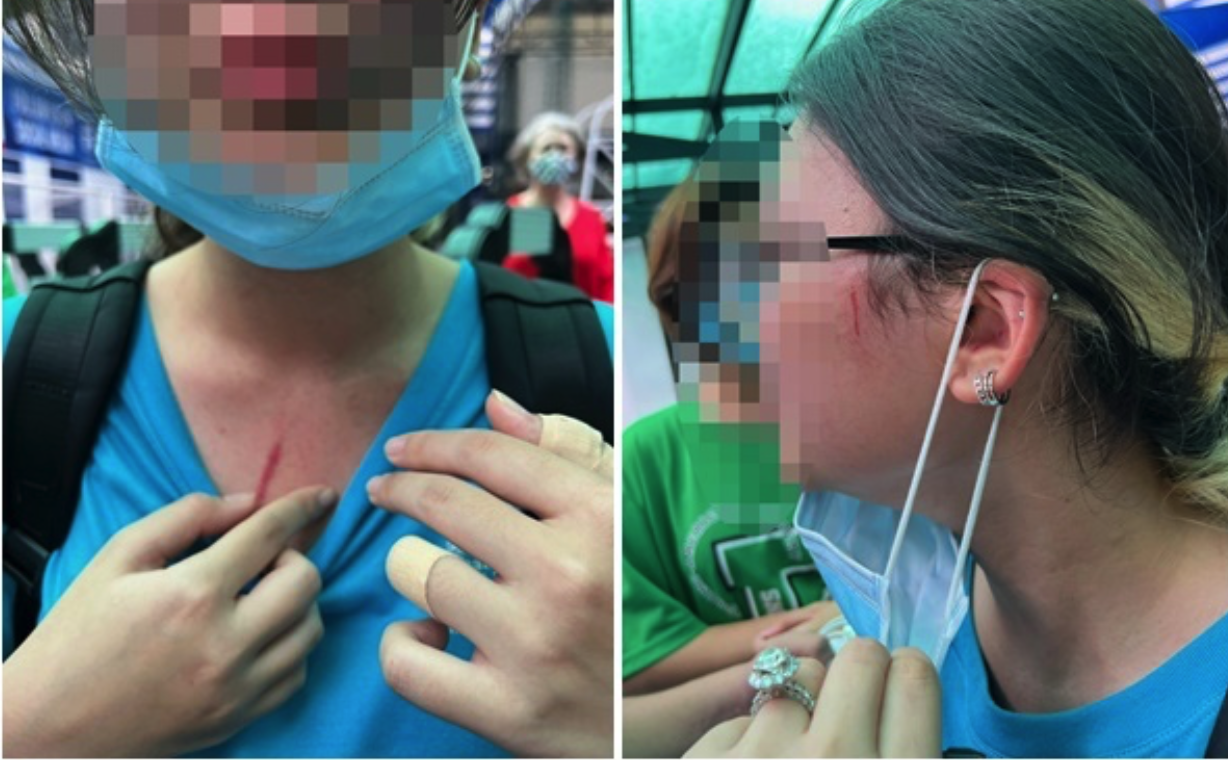 Việc một đứa trẻ ph&ocirc; b&agrave;y những vết thương tr&ecirc;n mạng x&atilde; hội được nhận x&eacute;t l&agrave; tổn thương lần 2