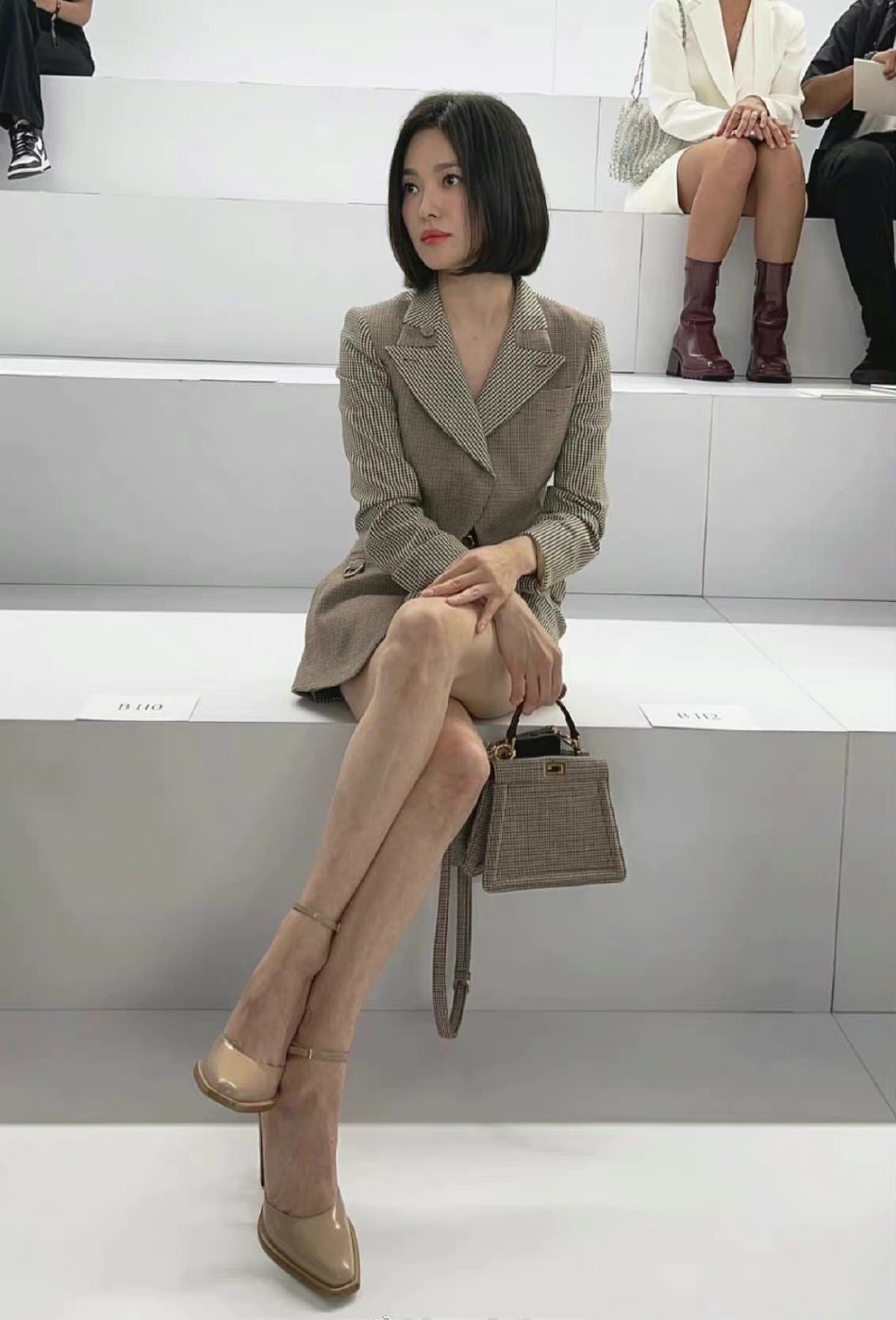Nhiều người bất ngờ bởi đ&ocirc;i ch&acirc;n gầy guộc, nổi 