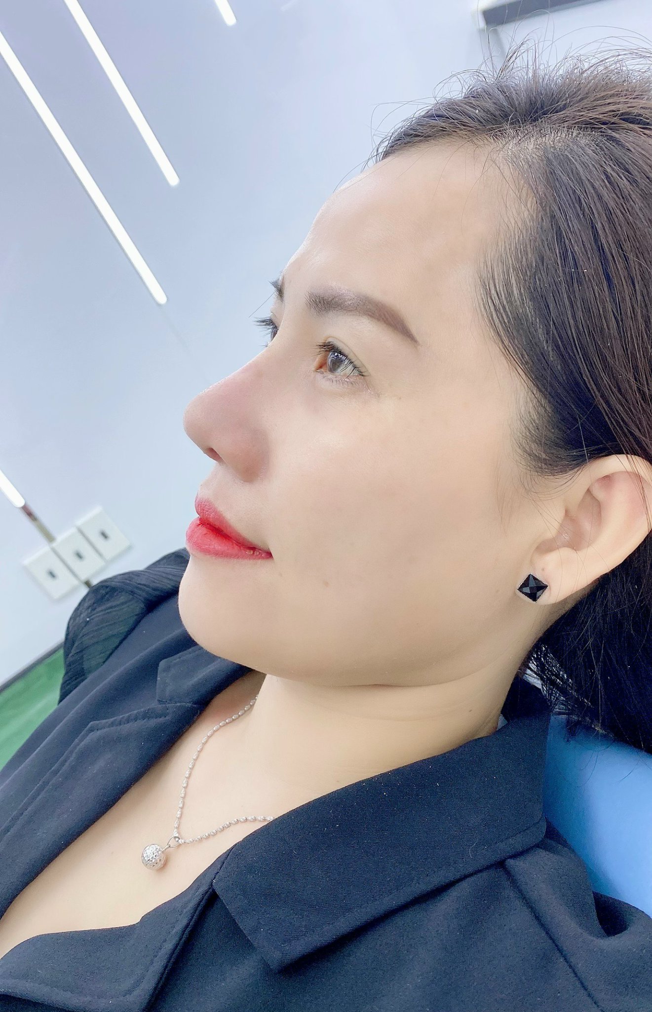 Khả năng nhiễm khuẩn gần như bằng không - Ảnh: Dr Đức Happy cung cấp