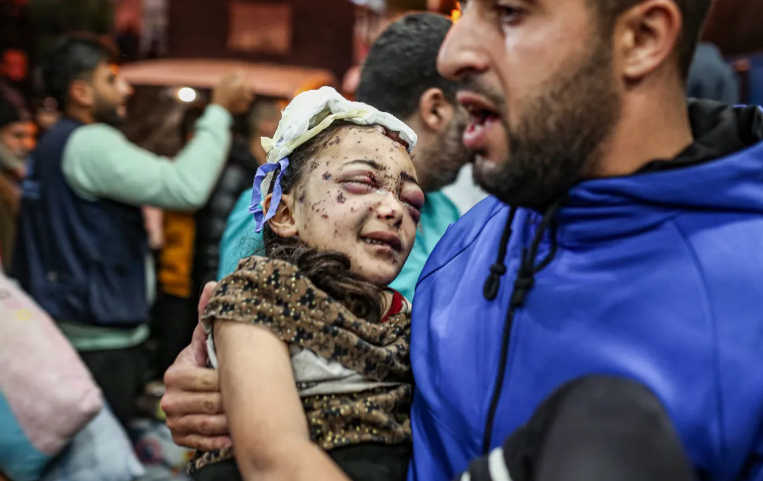 Tổ chức Bảo vệ Trẻ em Quốc tế-Palestine, một tổ chức phi ch&iacute;nh phủ, cho biết số trẻ em tử vong trong 12 tuần qua nhiều gấp đ&ocirc;i so với tổng số trẻ em Palestine thiệt mạng ở Bờ T&acirc;y v&agrave; Gaza bị chiếm đ&oacute;ng kể từ năm 1967 cộng lại.Một b&eacute; g&aacute;i bị thương nặng nhưng phải&nbsp;sơ t&aacute;n khỏi Bệnh viện Indonesia ở ph&iacute;a bắc Dải Gaza